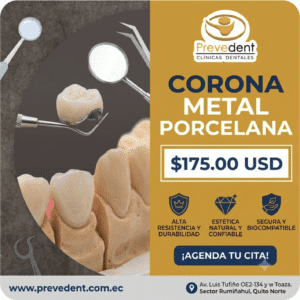 Corona en Metal Procelana